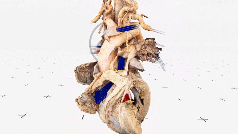 Medicalholodeck. Anatomy, Medical Imaging (DICOM), and Automatic ...